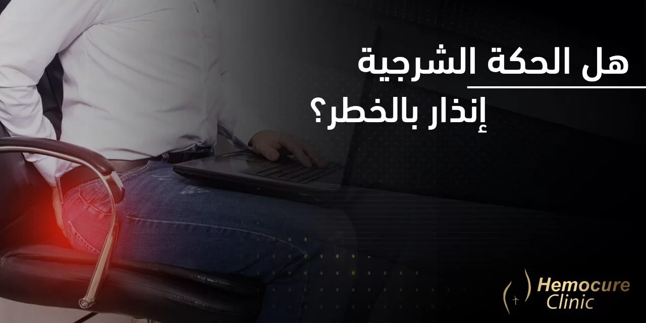 هل الحكة الشرجية تنذر بالخطر؟ هل الحكة الشرجية تنذر بالخطر؟