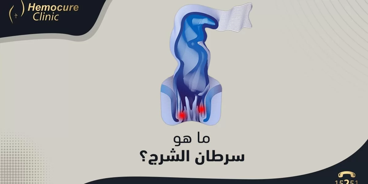 ما هو سرطان الشرج؟ ما هو سرطان الشرج؟