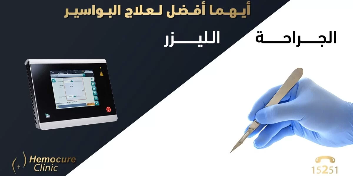 أيهما أفضل للبواسير: الجراحة أم الليزر؟