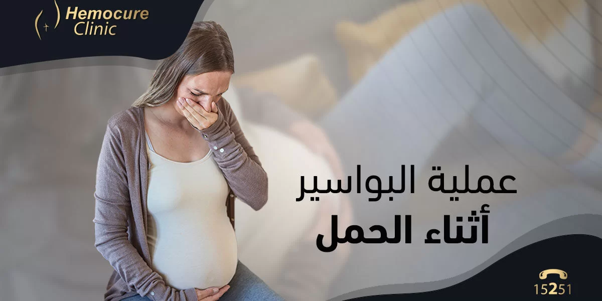 هل يمكن إجراء عملية البواسير أثناء الحمل؟