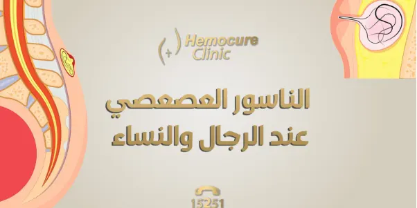 الناسور العصعصي عند الرجال والنساء