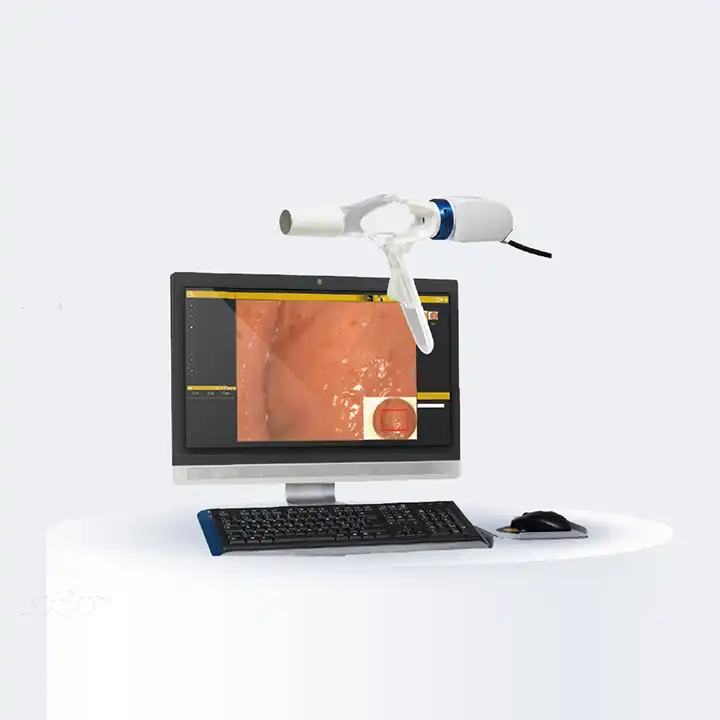 HR anoscopy