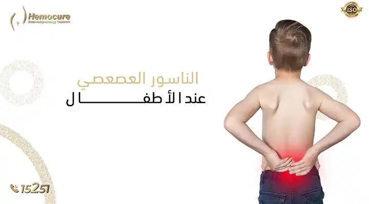 الناسور العصعصي عند الأطفال: الأسباب والأعراض وتقنيات العلاج