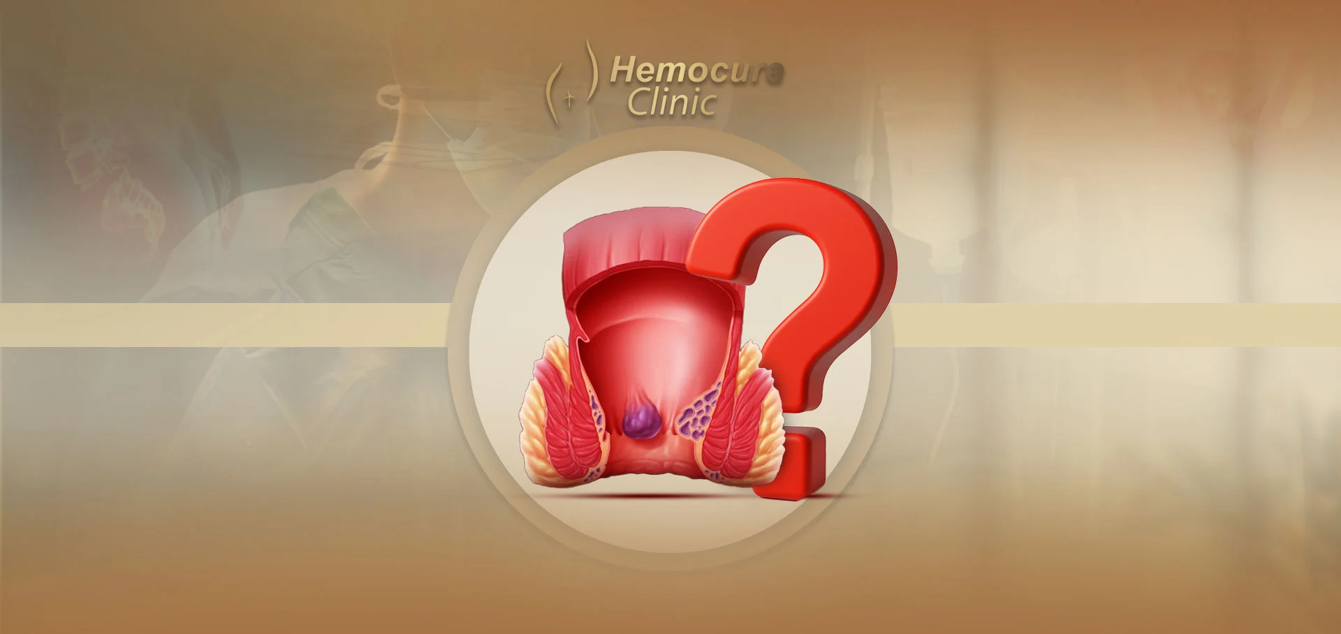 ما هي البواسير؟ الاسباب، الأعراض، وطرق العلاج الحديثة