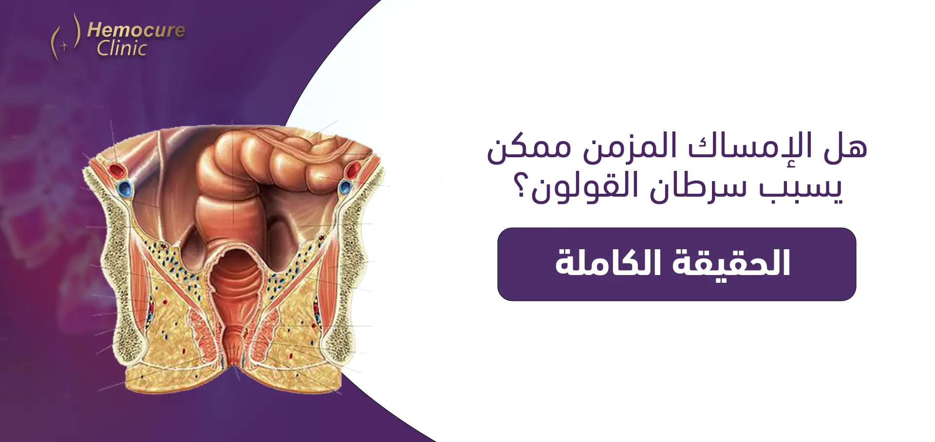 هل الإمساك المزمن يسبب سرطان القولون؟ الحقيقة الكاملة من "هيموكيور"